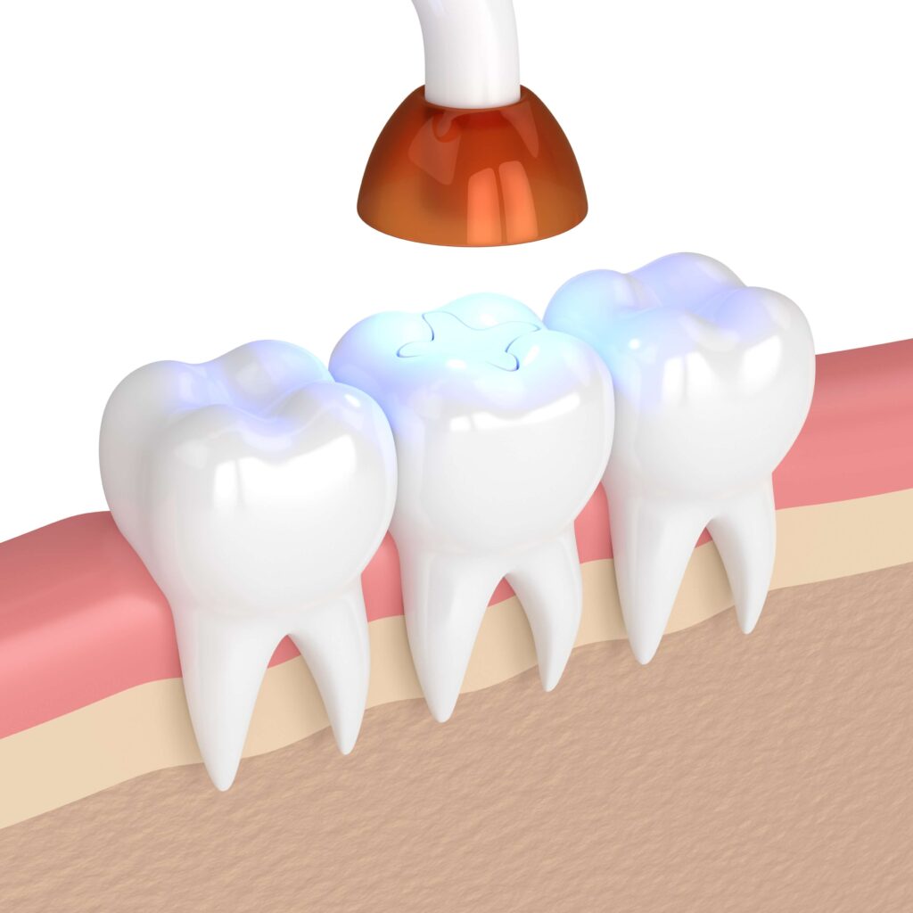 teeth composite fillings clinic pcmc