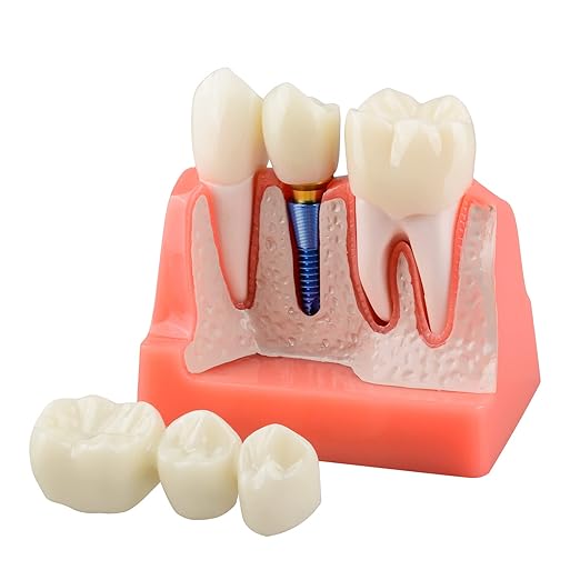 teeth crowns
