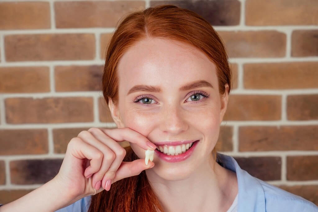 wisdom tooth removal